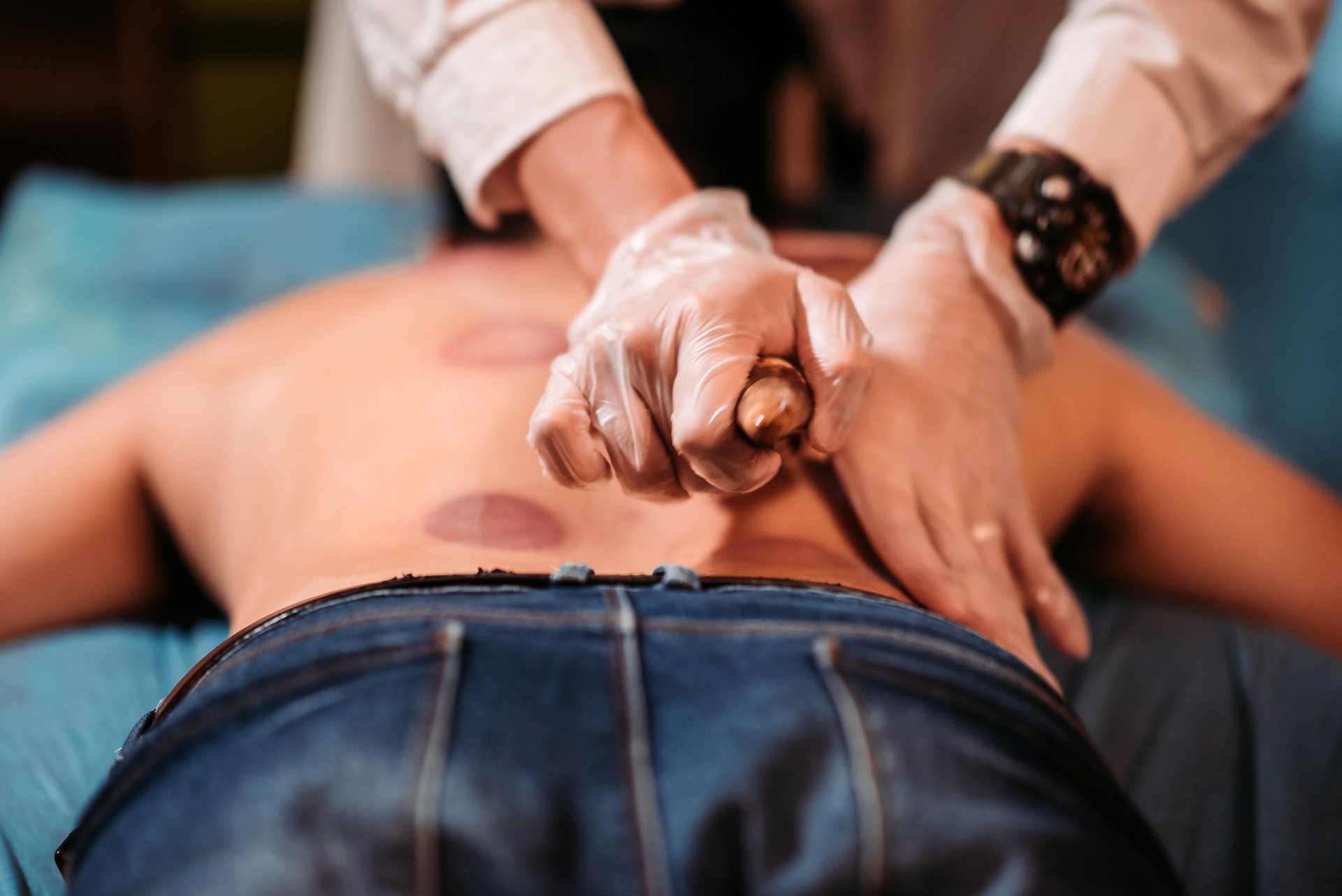 Asian chinese male patient receiving scraping therapy treatment at chinese medicine shop