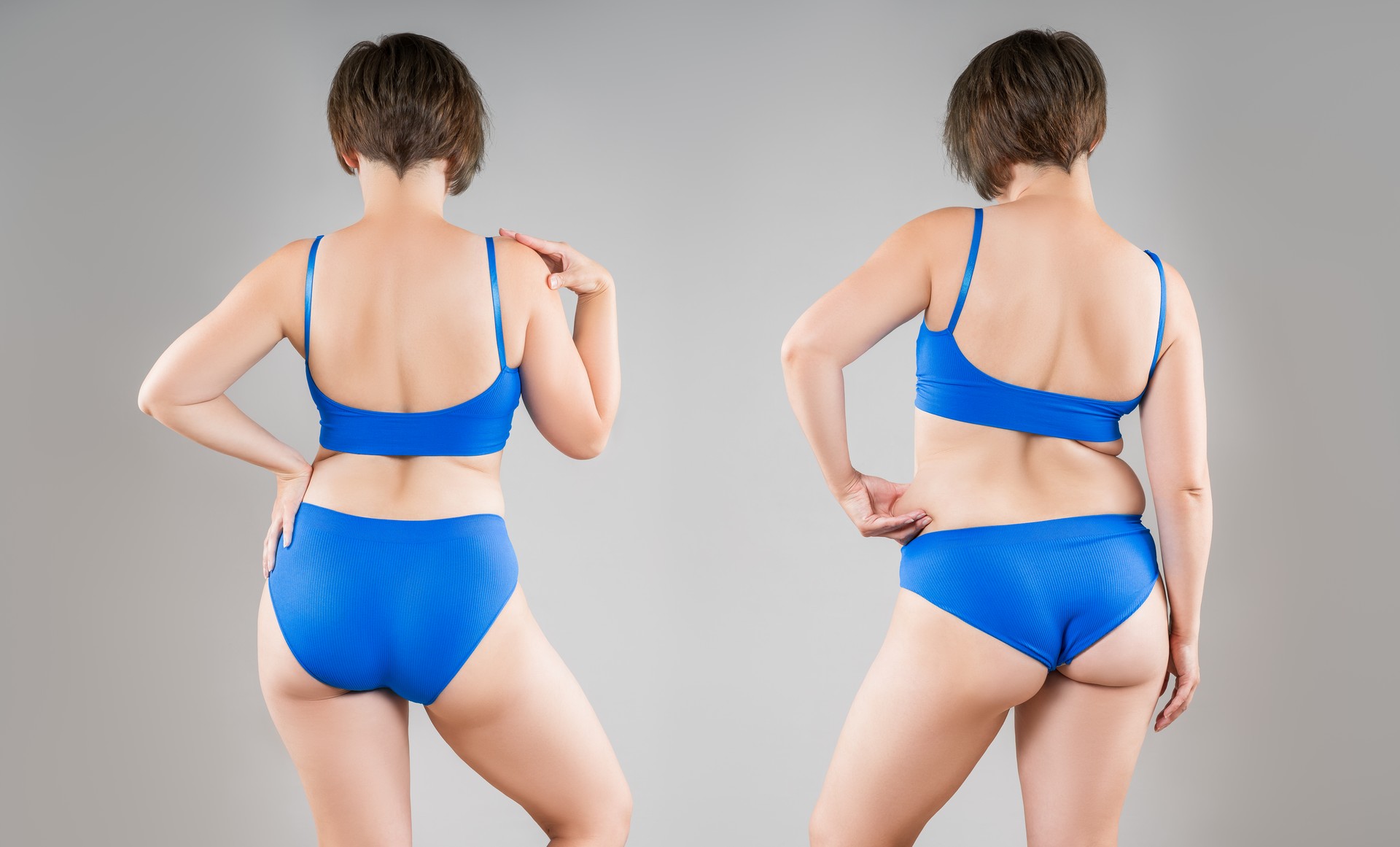 Female body before and after weight loss on gray background, woman in black lingerie with perfect buttocks in slimming concept, plastic surgery